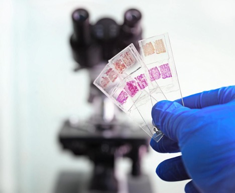 Hand in blue glove holding glass organ samples during Histological examination